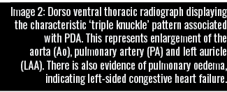 Image 2: Dorso ventral thoracic radiograph displaying the characteristic  triple knuckle  pattern associated with PDA   