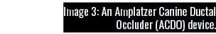 Image 3: An Amplatzer Canine Ductal Occluder (ACDO) device 