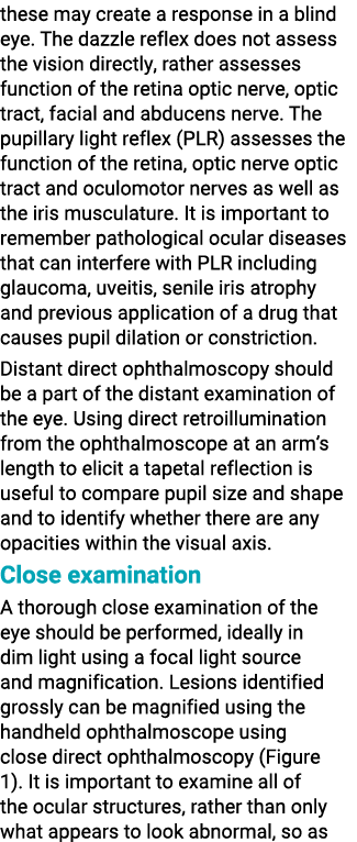 these may create a response in a blind eye  The dazzle reflex does not assess the vision directly, rather assesses fu   