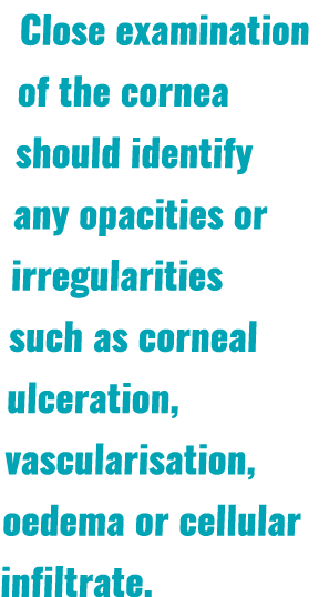 Close examination of the cornea should identify any opacities or irregularities such as corneal ulceration, vasculari   
