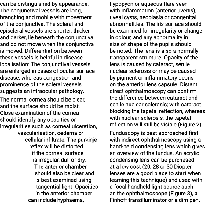 can be distinguished by appearance  The conjunctival vessels are long, branching and mobile with movement of the conj   