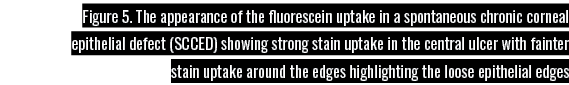 Figure 5  The appearance of the fluorescein uptake in a spontaneous chronic corneal epithelial defect (SCCED) showing   