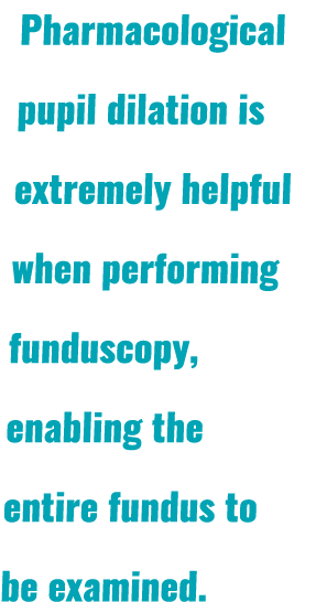 Pharmacological pupil dilation is extremely helpful when performing funduscopy, enabling the entire fundus to be exam   