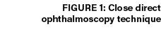 Figure 1: Close direct ophthalmoscopy technique