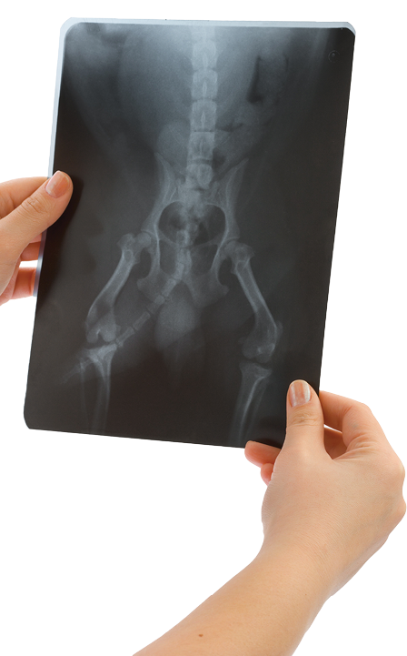 X-ray in hands isolated on white background