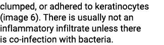 clumped, or adhered to keratinocytes (image 6). There is usually not an inflammatory infiltrate unless there is co in...