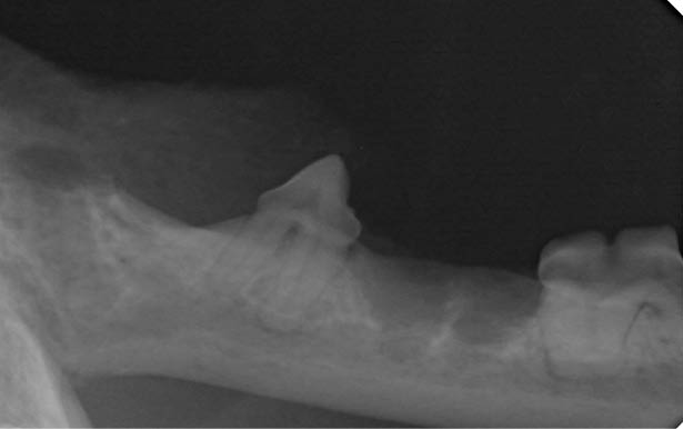 X-ray showing a side view of a lower jawbone with teeth and part of the neck bone. Description generated by AI