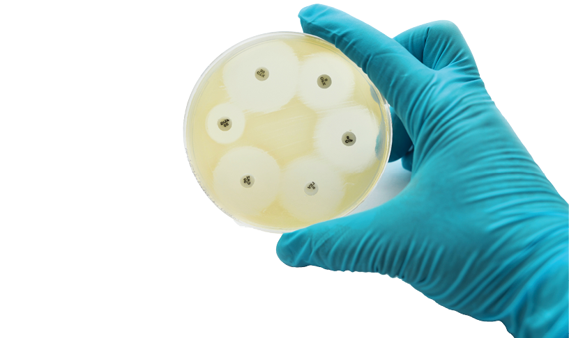 Antimicrobial susceptibility testing in petri dish