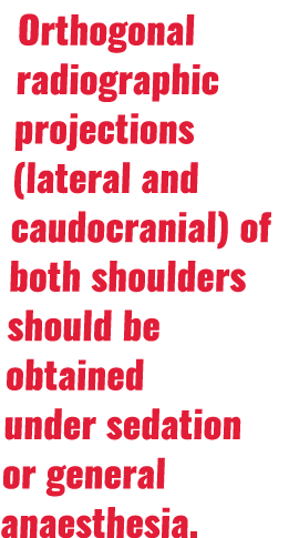 Orthogonal radiographic projections (lateral and caudocranial) of both shoulders should be obtained under sedation or   
