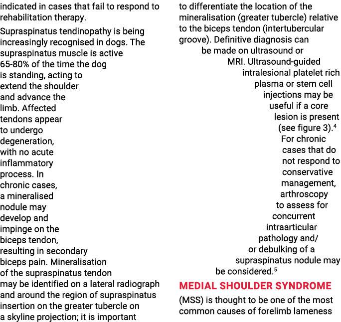 indicated in cases that fail to respond to rehabilitation therapy  Supraspinatus tendinopathy is being increasingly r   