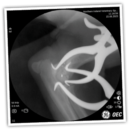 X-ray of a person's shoulder Description automatically generated