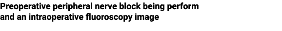 Preoperative peripheral nerve block being perform and an intraoperative fluoroscopy image