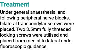 Treatment Under general anaesthesia, and following peripheral nerve blocks, bilateral transcondylar screws were place...