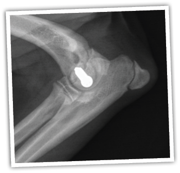 X-ray of a person's shoulder Description automatically generated